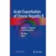 Acute Exacerbation of Chronic Hepatitis B: Volume 2. Diagnosis and Management