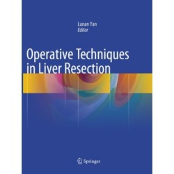 Operative Techniques in Liver Resection