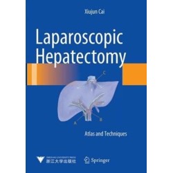 Laparoscopic Hepatectomy: Atlas and Techniques