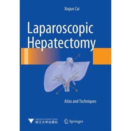 Laparoscopic Hepatectomy: Atlas and Techniques