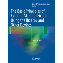 The Basic Principles of External Skeletal Fixation Using the Ilizarov and Other Devices