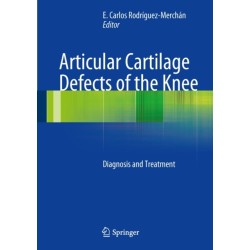 Articular Cartilage Defects of the Knee: Diagnosis and Treatment