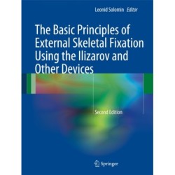 The Basic Principles of External Skeletal Fixation Using the Ilizarov and Other Devices