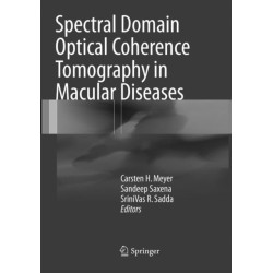 Spectral Domain Optical Coherence Tomography in Macular Diseases