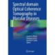 Spectral Domain Optical Coherence Tomography in Macular Diseases