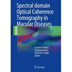 Spectral Domain Optical Coherence Tomography in Macular Diseases
