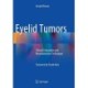 Eyelid Tumors: Clinical Evaluation and Reconstruction Techniques