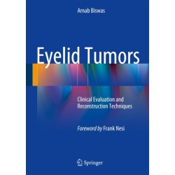 Eyelid Tumors: Clinical Evaluation and Reconstruction Techniques
