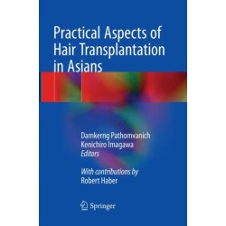 Practical Aspects of Hair Transplantation in Asians