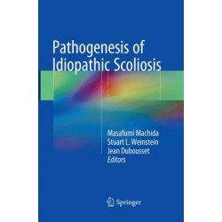 Pathogenesis of Idiopathic Scoliosis