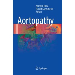 Aortopathy