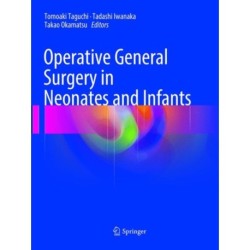 Operative General Surgery in Neonates and Infants