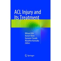 ACL Injury and  Its Treatment