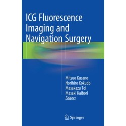 ICG Fluorescence Imaging and Navigation Surgery