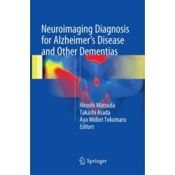 Neuroimaging Diagnosis for Alzheimer's Disease and Other Dementias