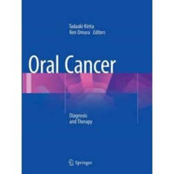 Oral Cancer: Diagnosis and Therapy