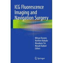 ICG Fluorescence Imaging and Navigation Surgery