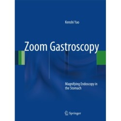 Zoom Gastroscopy: Magnifying Endoscopy in the Stomach