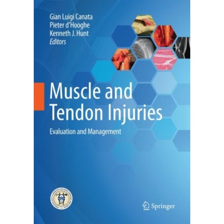 Muscle and Tendon Injuries: Evaluation and Management