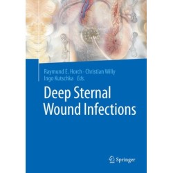 Deep Sternal Wound Infections