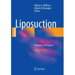 Liposuction: Principles and Practice
