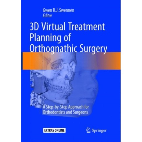 3D Virtual Treatment Planning of Orthognathic Surgery: A Step-by-Step Approach for Orthodontists and Surgeons