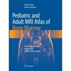 Pediatric and Adult MRI Atlas of Bone Marrow: Normal Appearances, Variants and Diffuse Disease States