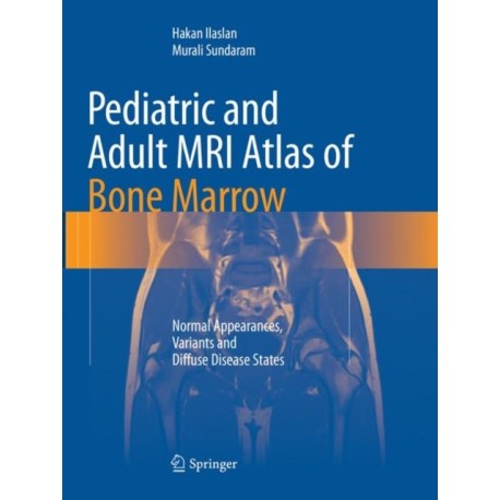 Pediatric and Adult MRI Atlas of Bone Marrow: Normal Appearances, Variants and Diffuse Disease States