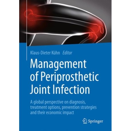 Management of Periprosthetic Joint Infection: A global perspective on diagnosis, treatment options, prevention strategies and their economic impact
