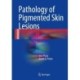 Pathology of Pigmented Skin Lesions