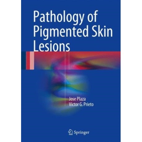 Pathology of Pigmented Skin Lesions