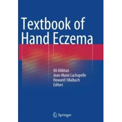 Textbook of Hand Eczema