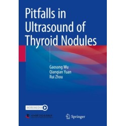 Pitfalls in Ultrasound of Thyroid Nodules