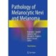 Pathology of Melanocytic Nevi and Melanoma