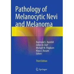 Pathology of Melanocytic Nevi and Melanoma
