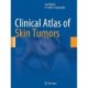 Clinical Atlas of Skin Tumors
