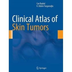 Clinical Atlas of Skin Tumors