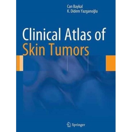 Clinical Atlas of Skin Tumors