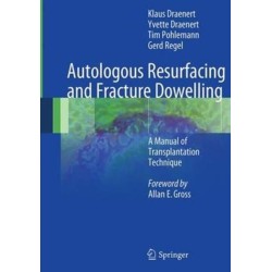 Autologous Resurfacing and Fracture Dowelling: A Manual of Transplantation Technique