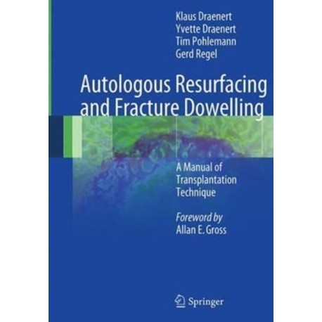 Autologous Resurfacing and Fracture Dowelling: A Manual of Transplantation Technique