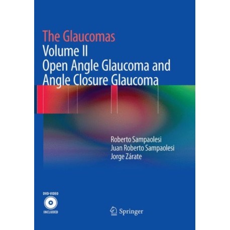 The Glaucomas: Volume II - Open Angle Glaucoma and Angle Closure Glaucoma