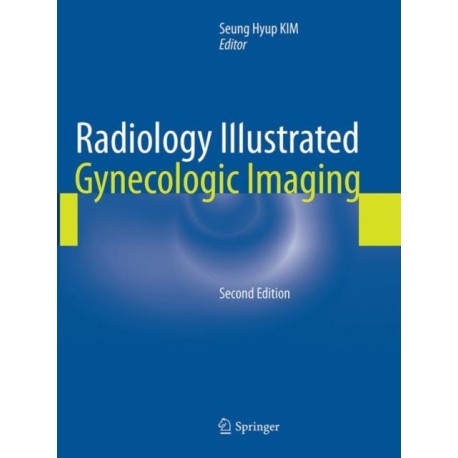Radiology Illustrated: Gynecologic Imaging