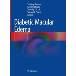 Diabetic Macular Edema