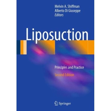 Liposuction: Principles and Practice