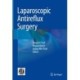 Laparoscopic Antireflux Surgery