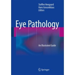 Eye Pathology: An Illustrated Guide