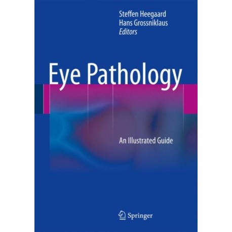 Eye Pathology: An Illustrated Guide