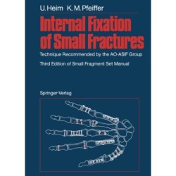 Internal Fixation of Small Fractures: Technique Recommended by the AO-ASIF Group