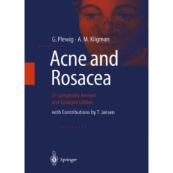 ACNE and ROSACEA