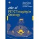 Atlas of PET/CT Imaging in Oncology